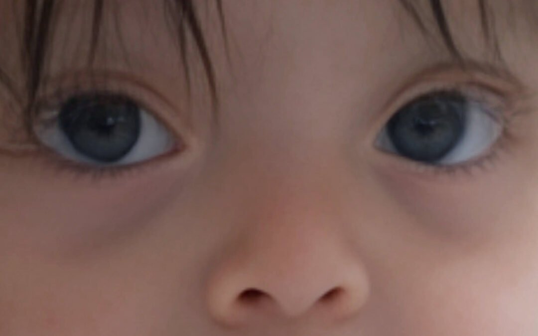 Una mirada al Síndrome de Down